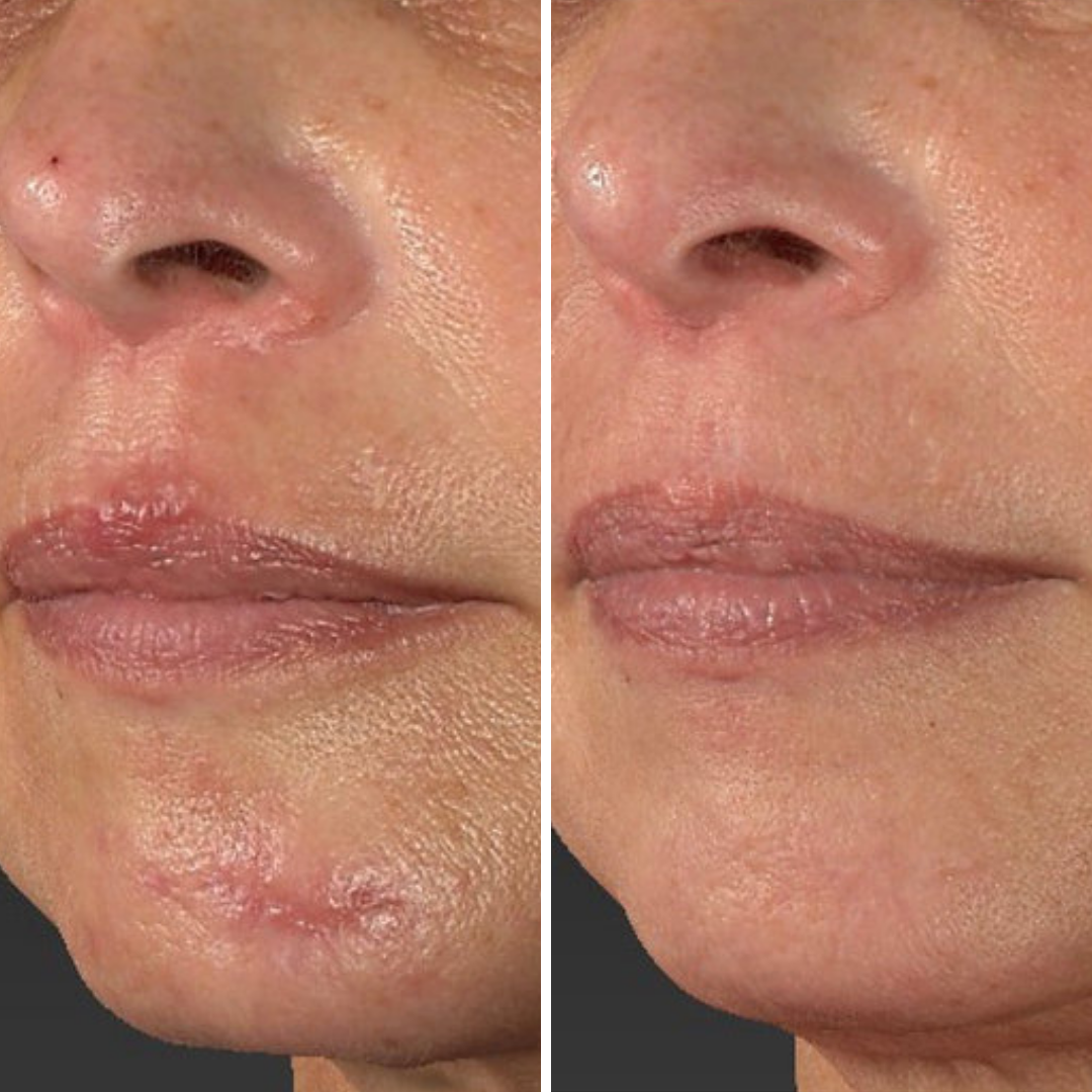 polinucleotidos tratamiento (6)