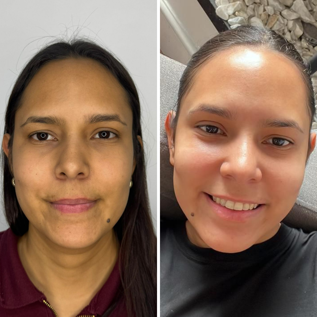 polinucleotidos tratamiento (8)